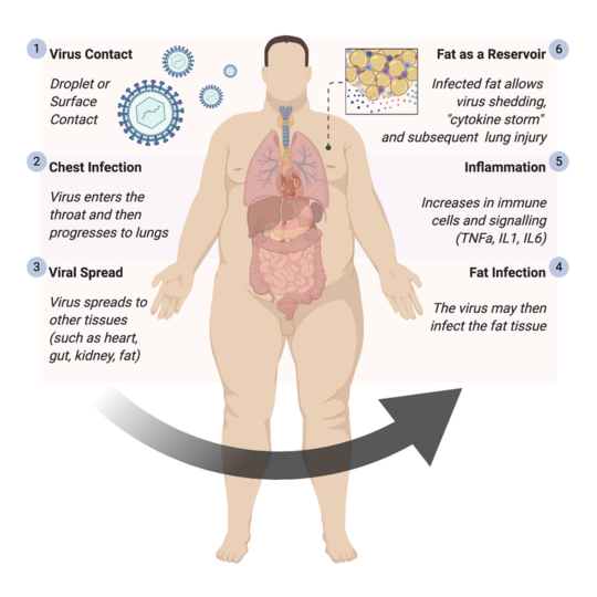 Coronavirus Linked To Greater Risk Of Life Threatening Infection In People With Obesity
